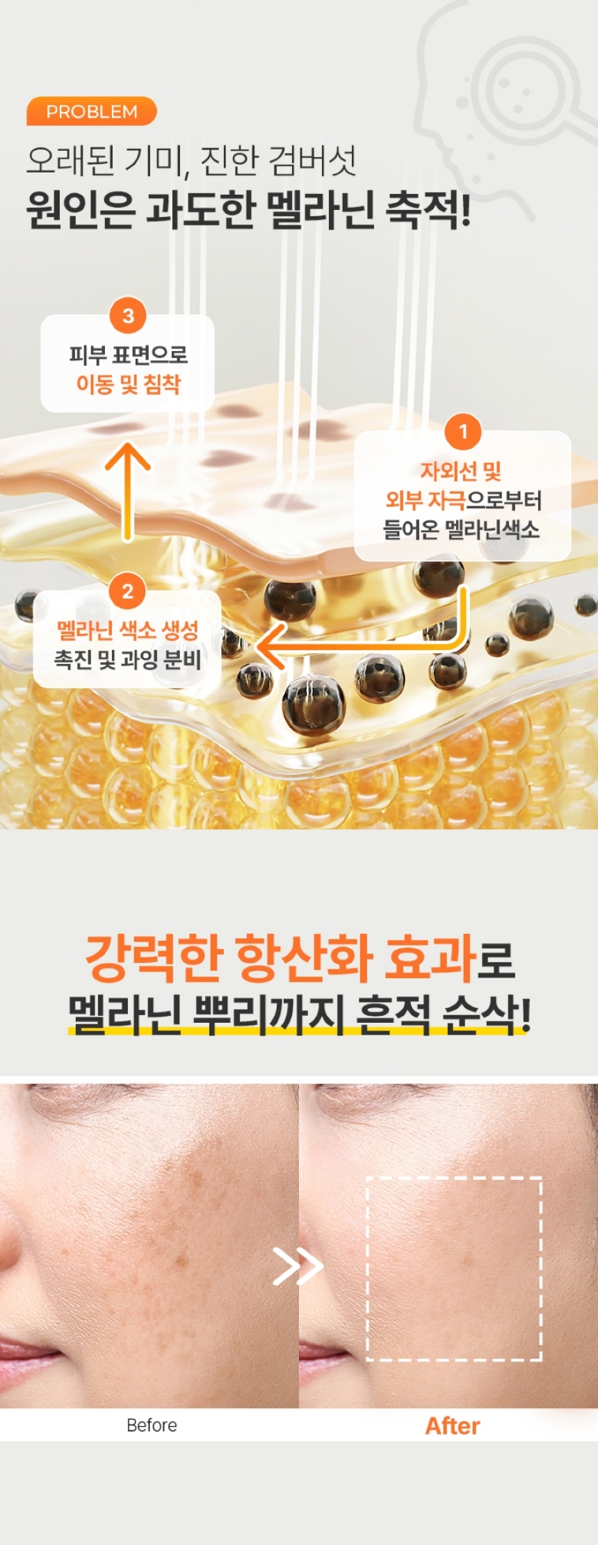 (분할1)-글루타치온-상세페이지_860_03 (이거사용).jpg